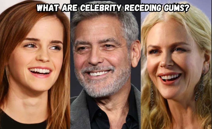 celebrity receding gums